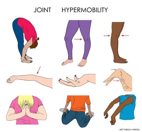 All Flex And No Pecs Why Hypermobile Bodies Need Pilates — Kirsti