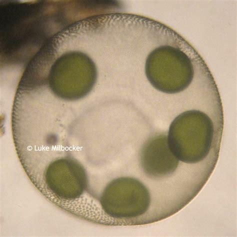 Volvox Under Microscope Micropedia