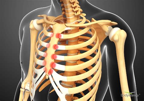 Anatomy Of Right Side Of Back Of Rib Cage Rib Pain With Breathing