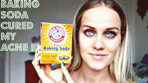 Baking Soda Cured My Acne In 10 Days Experiment Worked Youtube