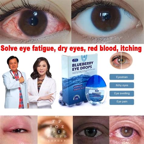 Instocks Blueberries Eye Drops Original For Clear Vision Dry Eyes