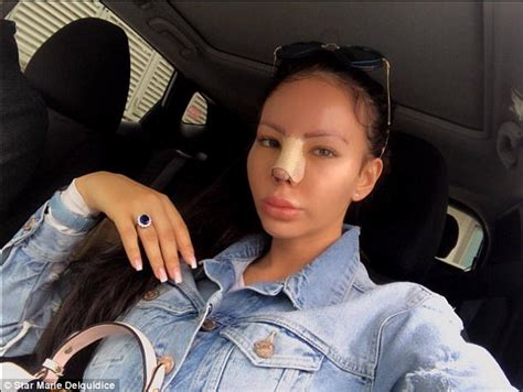 Birmingham Woman Is Addicted To Plastic Surgery Daily Mail Online
