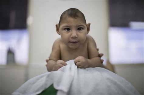 As Babies Born To Mothers Infected With The Zika Virus Turn 1 Health