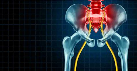 What Causes Sciatic Leg Pain And Can It Be Treated Pain Relief Partners