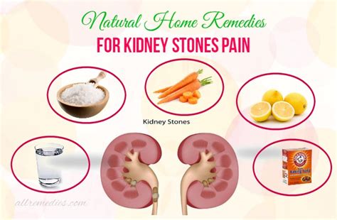 Top 9 Natural Home Remedies For Kidney Stones Pain You Should Know