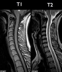 Cop i & ii and clathrin. T1 vs. T2 MRI Images - Frompo