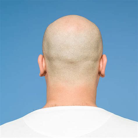 Back Of Head Completely Bald Shaved Head Balding Stock Photos Pictures