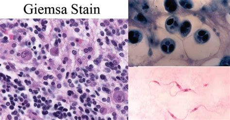 Giemsa Stain Principle Procedure Results Applications Biology Ease