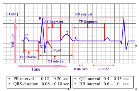 Laboratory Electrocardiogram Ecg Diagram Quizlet