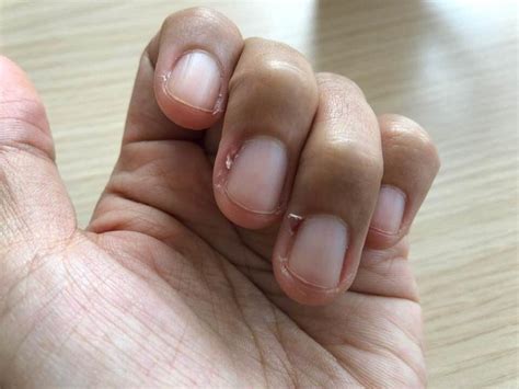How To Care For Your Cuticles And Deal With Pesky Hangnails Gma News