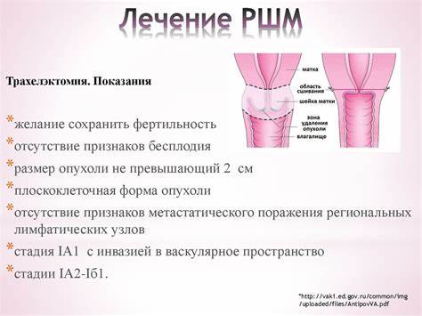Диета рак шейки матки Диета рак шейки матки