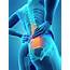 Human Spine And Back Pain Photograph By Sebastian Kaulitzki/science 