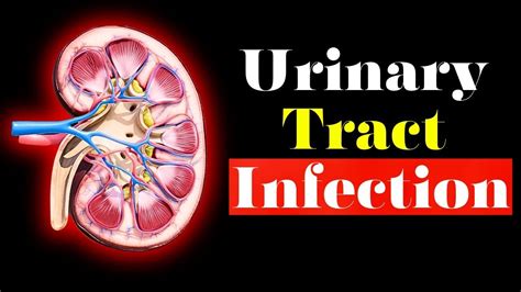 Urinary Tract Infection Overview Signs And Symptoms Pathophysiology Causes And Treatment