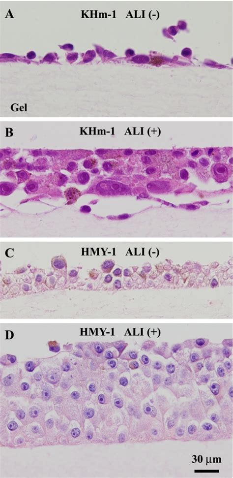 Histology Of Two Melanoma Cell Types Of Khm 1 A And B And Hmy 1 C