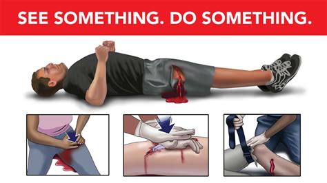 A 60 Kit Could Help Stop The Bleed Save A Life The Reporter Uab