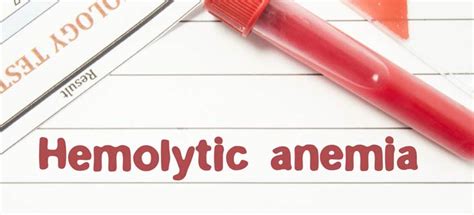 Hemolytic Anemia Causes Symptomstypes And Treatment
