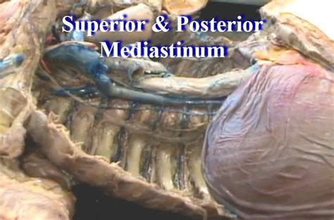 Mediastinum Anatomy