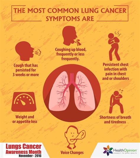 Some common symptoms of lung cancer include, according to lungcancer.com cause of lung cancer - DriverLayer Search Engine