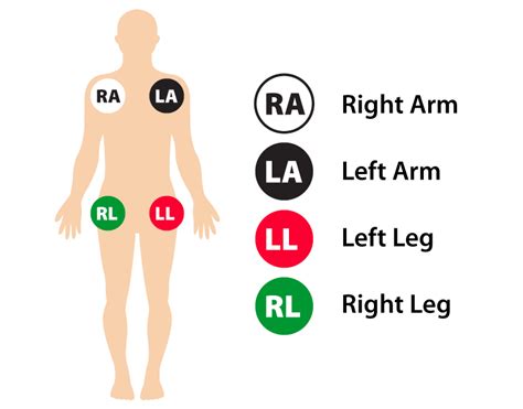 12 Lead Ecg Placement Guide With Illustrations