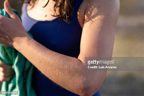 goose bumps arm photos and premium high res pictures getty images