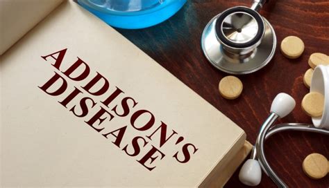 Addisons Disease New Guideline Details Diagnosis And Treatment