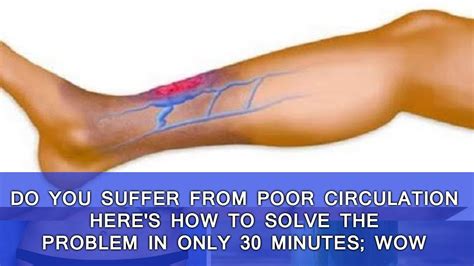 Do You Suffer From Poor Circulation Heres How To Solve The Problem In