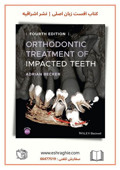 Orthodontic Treatment Of Impacted Teeth 4th Edition 2022