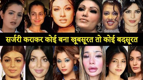 SHOCKING Plastic Surgery Of Bollywood Actresses BEFORE AFTER YouTube