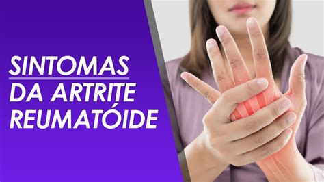 SINTOMAS da Artrite Reumatóide YouTube