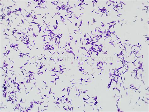 Clostridium Species Gram Stain