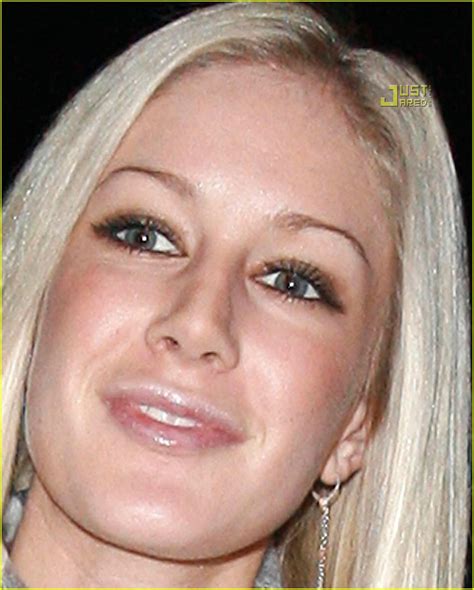 Albums 99 Pictures Heidi Montag Before And After Pictures Latest