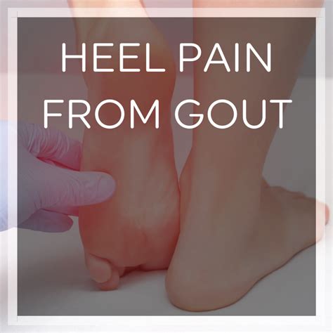 Can Uric Acid Cause Heel Pain Signs Of Gout In The Heel Heel That Pain