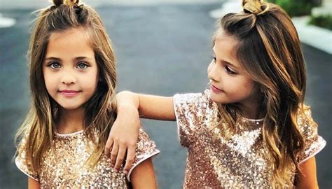 these twins were named “most beautiful in the world ” wait till you see them today