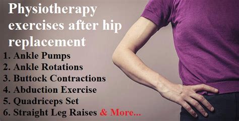 Physiotherapy Exercises After Hip Replacement