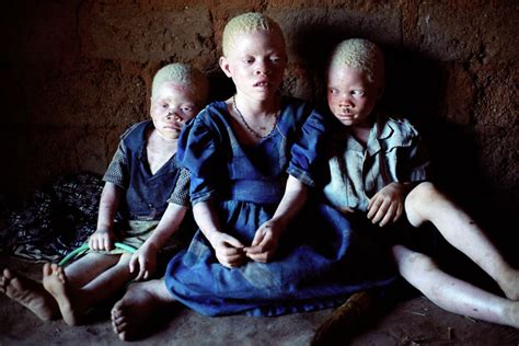 58 Albino People Wholl Mesmerize You With Their Otherworldly Beauty In
