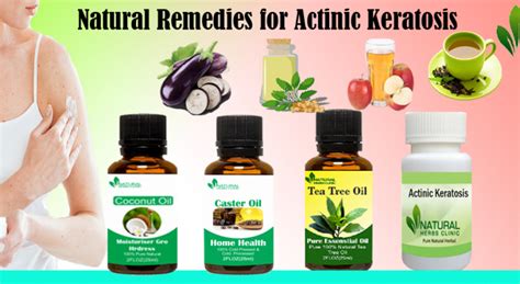 Tested Natural Remedies For Actinic Keratosis Treatment