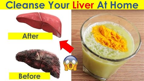 Cleanse Your Liver At Home Natural Liver Detox Drink Youtube
