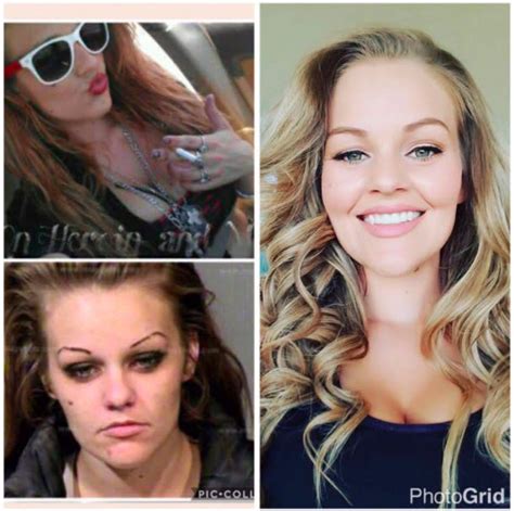 Mother Shares Before And After Photos Of Meth Addiction Inspires Many