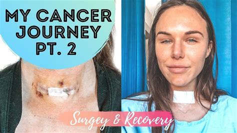 My Thyroid Cancer Journey Part 2 Surgery And Recovery Youtube