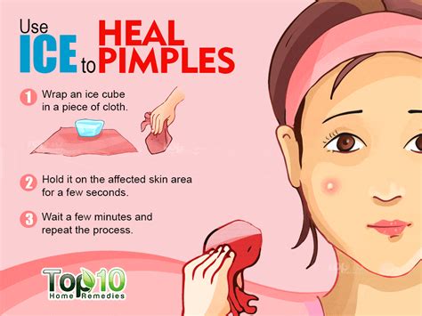 How To Get Rid Of Pimples Fast Top 10 Home Remedies