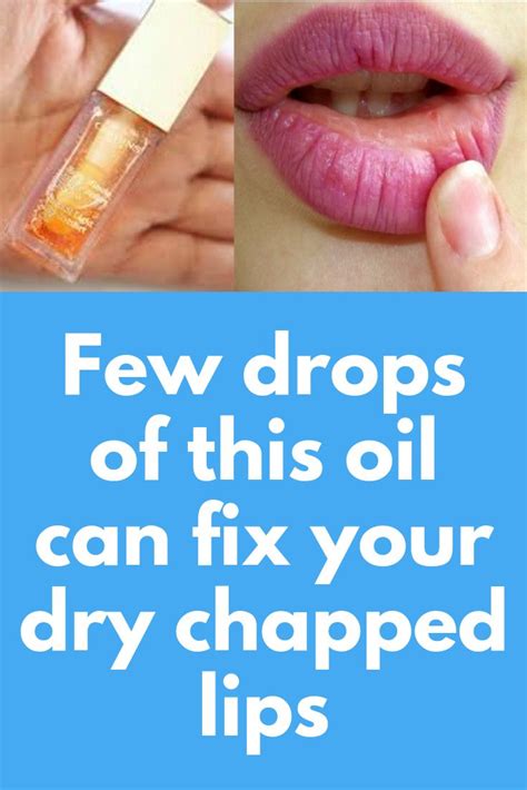 Few Drops Of This Oil Can Fix Your Dry Chapped Lips This Article