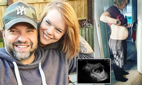 Couple Beat Odds Of 200 Million To One To Naturally Conceive Identical