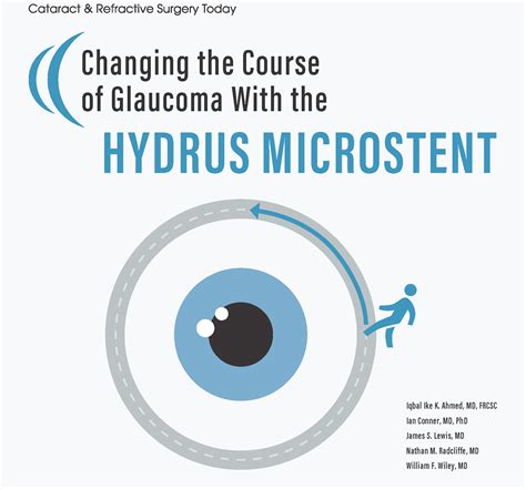 Changing The Course Of Glaucoma With Hydrus Microstent February 2020