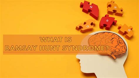 Ramsay Hunt Syndrome Causes Symptoms Complications Diagnosis And