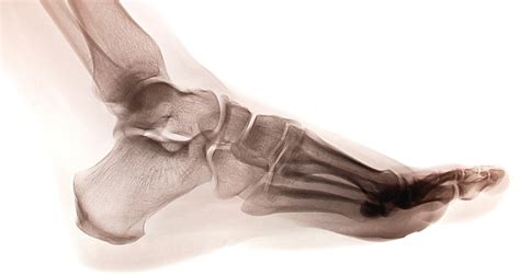 What You Need To Know About The Biomechanics Of The Foot And Ankle