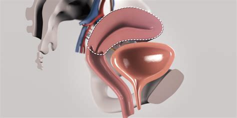 Total Laparoscopic Hysterectomy TVASurg The Toronto Video Atlas Of