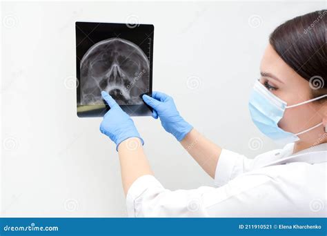 Sinusitis Film X Ray Of Human Skull With Inflamed At Sinus Royalty Free Stock Photo