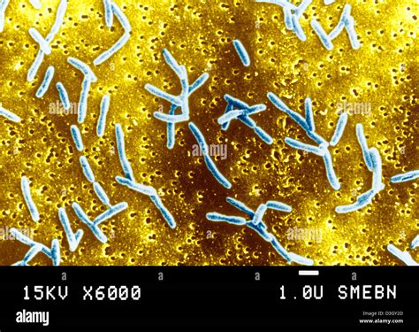 Campylobacter Jejuni Stock Photo Alamy