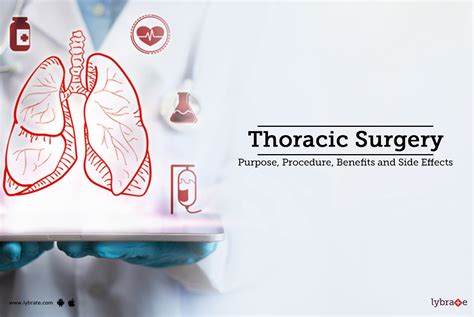 Thoracic Surgery Purpose Procedure And Benefits And Side Effects