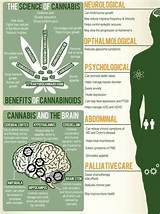 Alabama Medical Marijuana
